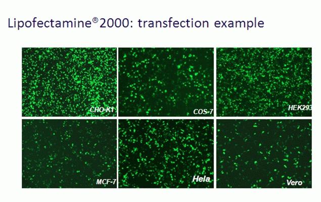 Lipofectamine® 2000 transfection example