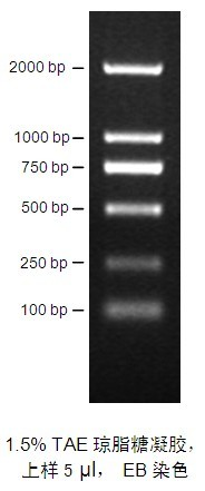 产品电泳图(5 &mu;l)